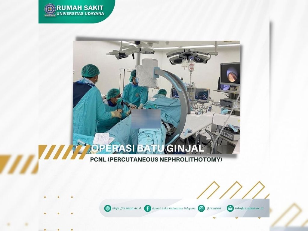 Informasi PCNL (Percutaneous Nephrolithotomy)