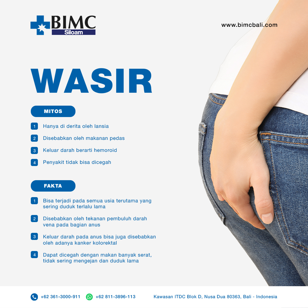 Wasir , Mitos dan Fakta