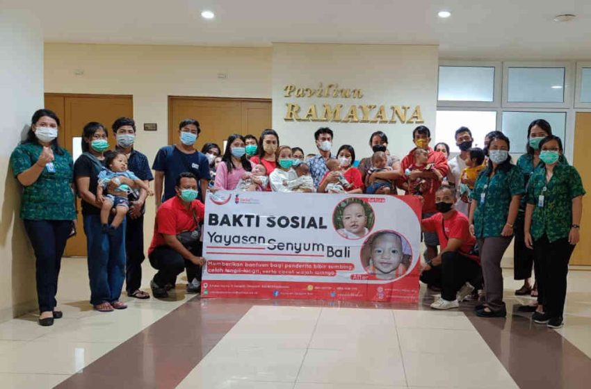 RSU. Kasih Ibu Tabanan Didukung Yayasan Senyum Bali, Sukses Gelar Operasi Bibir Sumbing