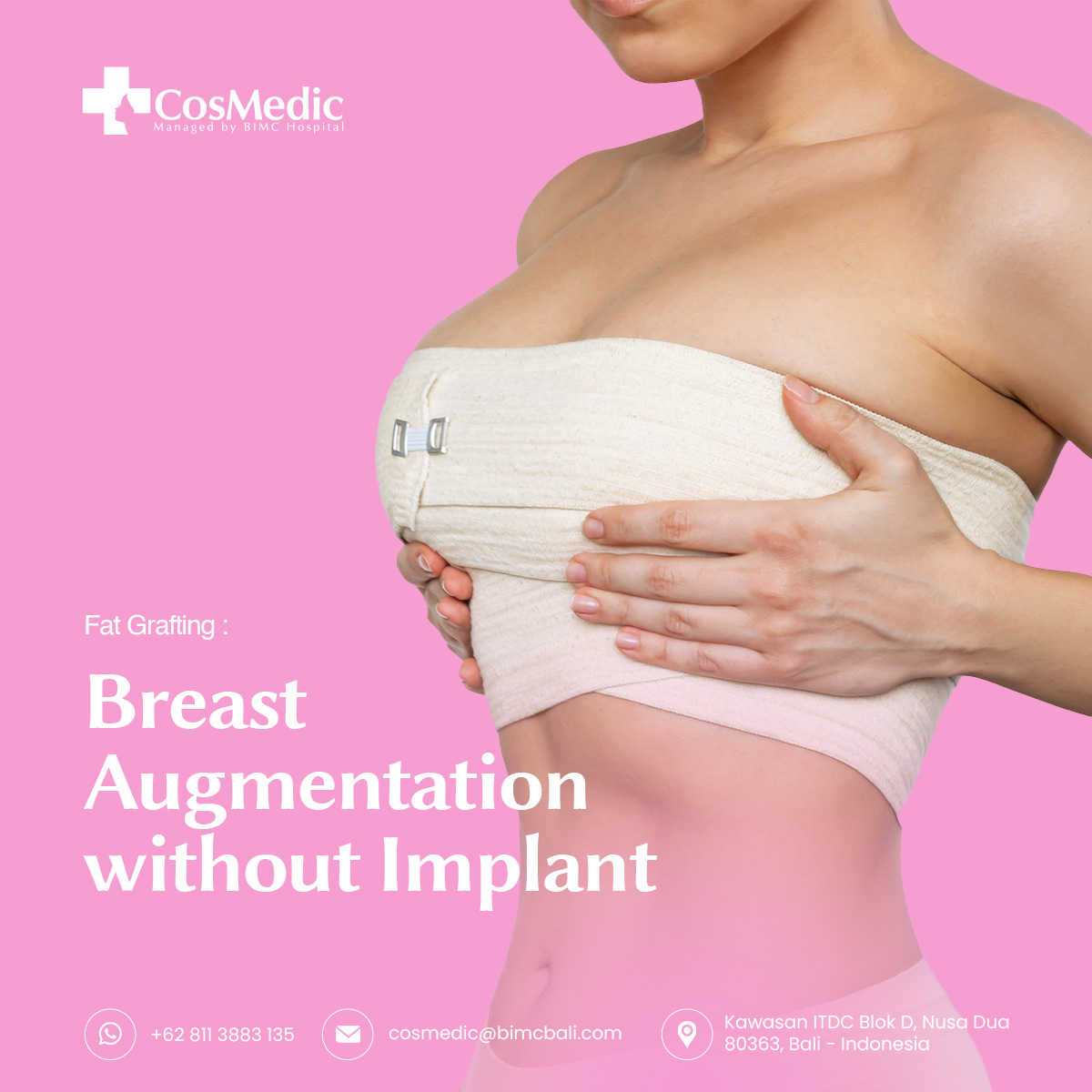 Fat Grafting: Breast augmentation without implant