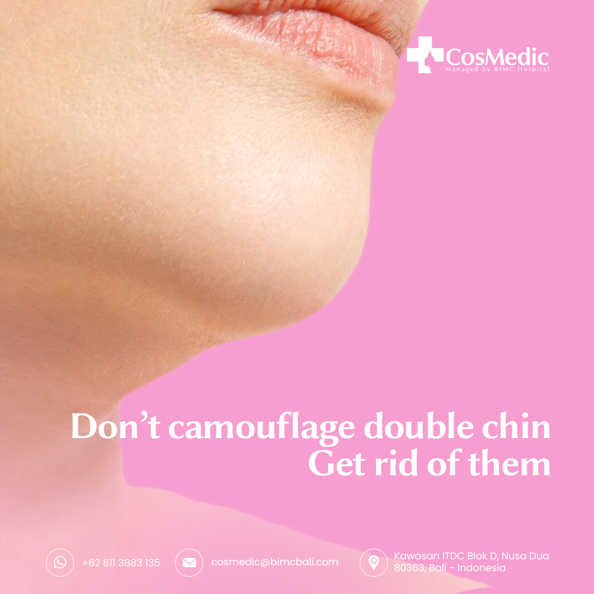 Don’t camouflage double chin get rid of them with